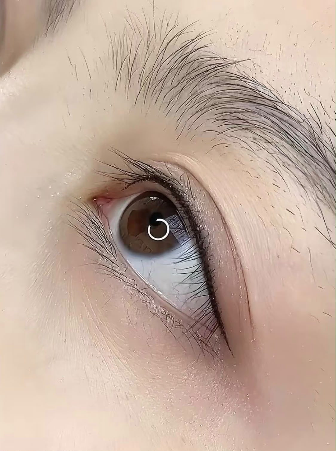 角蛋白蹺睫